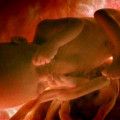 Conselho de Medicina defende liberação do aborto até 12ª semana Conselho de Medicina defende liberação do aborto até 12ª semana